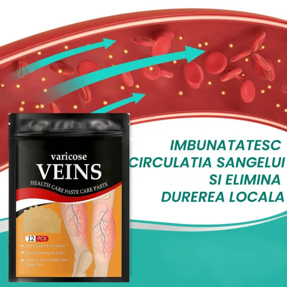 Plasturi pentru tratarea varicelor
