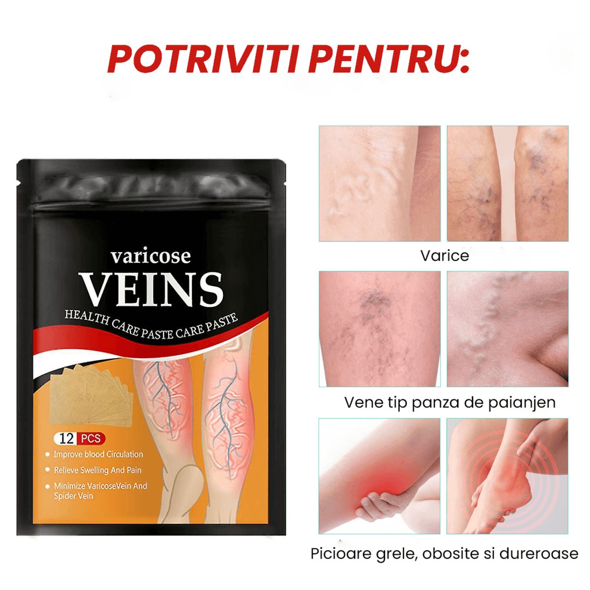 Plasturi pentru tratarea varicelor